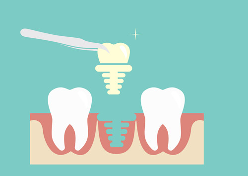 【月经期间拔牙的危害有哪些】拔牙有哪些危害 拔牙的并发症介绍