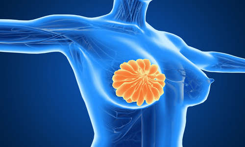 乳腺癌会向哪几个部位转移 如何让降低复发率