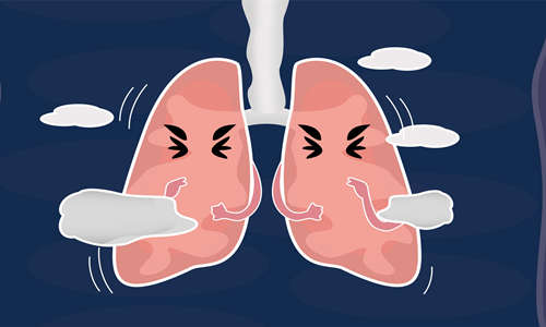 什么是肺纤维化 肺纤维化的临床症状
