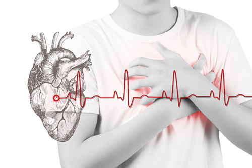 心肌缺血是怎么造成的 心肌缺血的原因