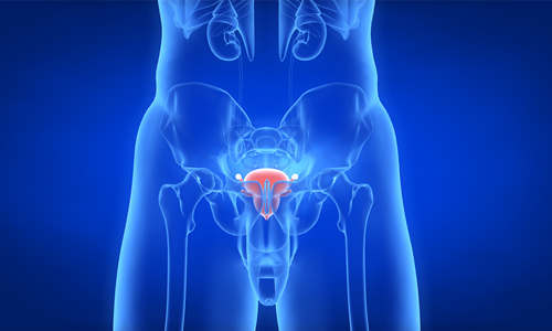 前列腺结石有哪些危害 如何治疗