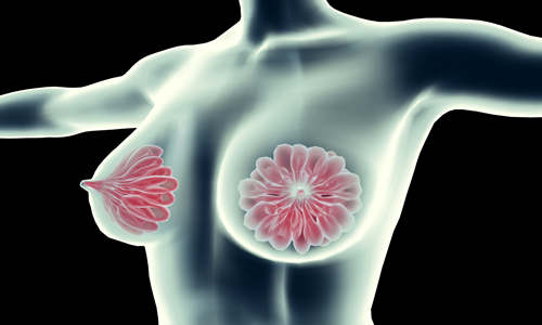 乳腺增生早期有哪些症状 如何预防