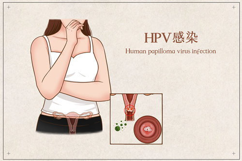 深圳HPV二价疫苗接种对象+接种不良反应